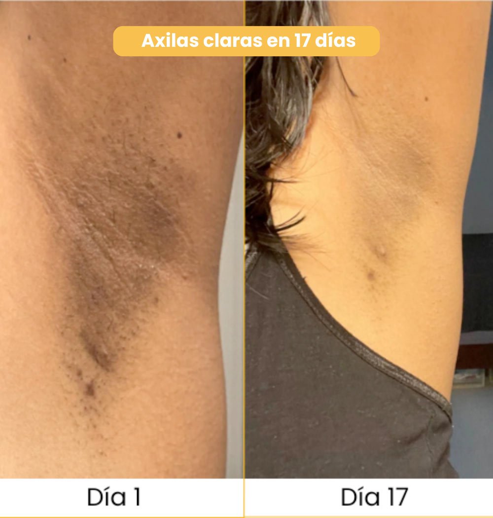 Jabón TUMERIC | Jabón Natural de Cúrcuma: Oro para tu Piel 🌿.