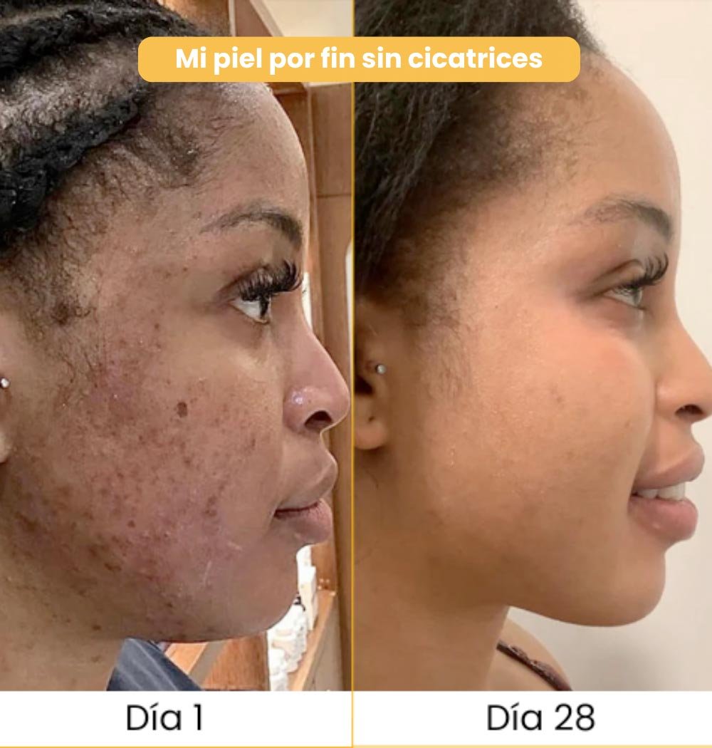 Jabón TUMERIC | Jabón Natural de Cúrcuma: Oro para tu Piel 🌿.