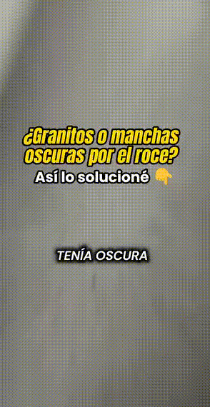 Jabón TUMERIC | Jabón Natural de Cúrcuma: Oro para tu Piel 🌿.